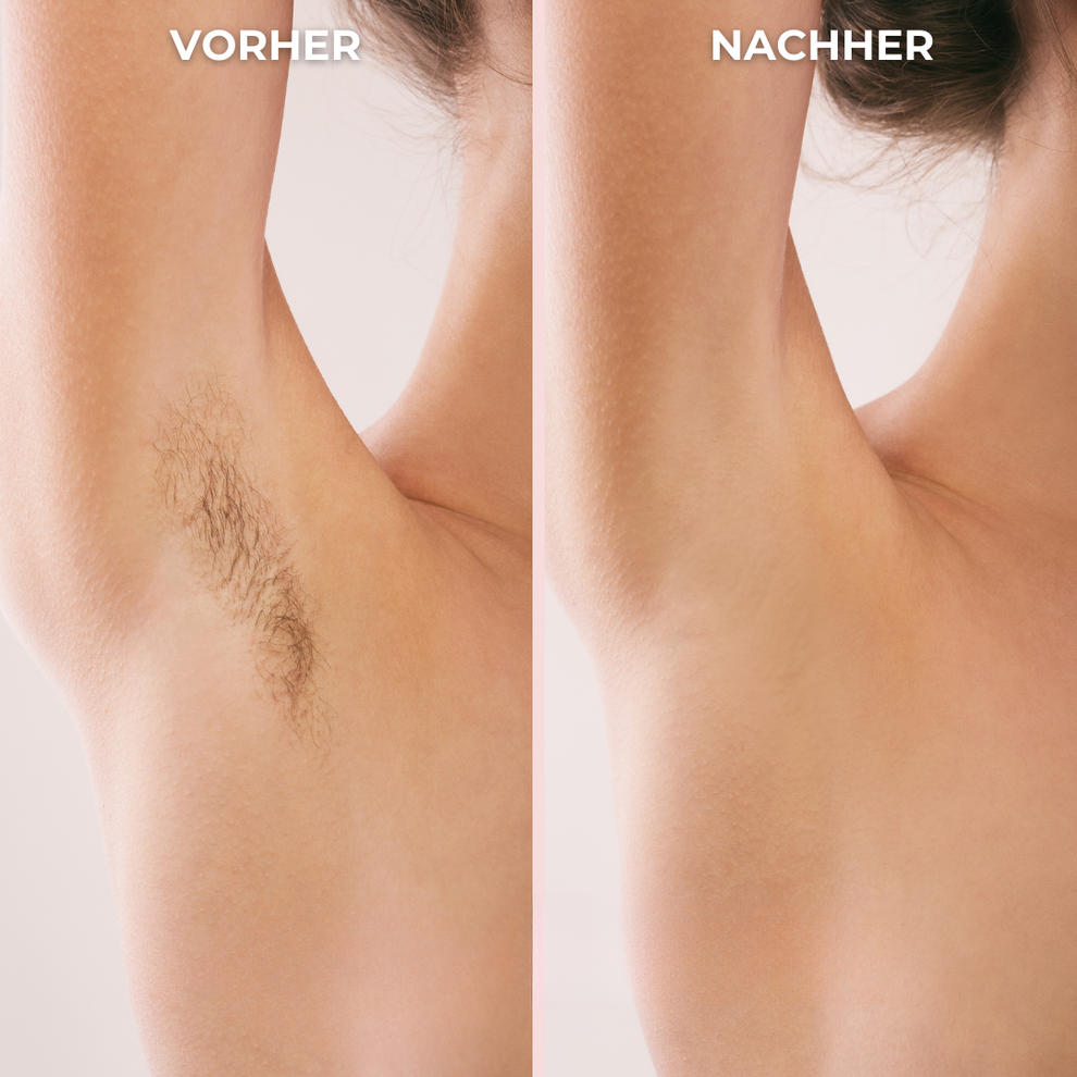 Smoothwave™ Bikini-Trimmer für Frauen