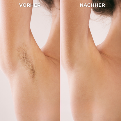 Smoothwave™ Bikini-Trimmer für Frauen