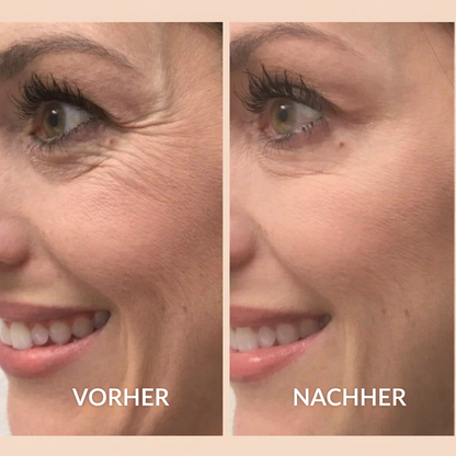 Melano® Silikon-Narbenpflaster